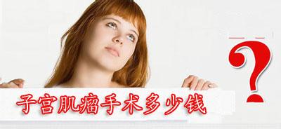 子宫肌瘤治疗费用是多少